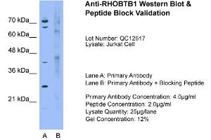 Host:  Rabbit  Target Name:  RHOBTB1  Sample Type:  Jurkat  Lane A:  Primary Antibody  Lane B:  Primary Antibody + Blocking Peptide  Primary Antibody Concentration:  4.