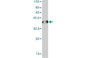 Western Blot detection against Immunogen (37. (OTX1 抗体  (AA 10-116))