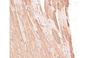 Immunohistochemistry of paraffin-embedded Mouse heart using KIF1C Polyclonal Antibody at dilution of 1:100 (40x lens). (KIF1C 抗体)