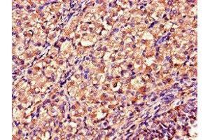 Immunohistochemistry of paraffin-embedded human ovarian tissue using ABIN7160797 at dilution of 1:100 (DDAH2 抗体  (AA 1-285))