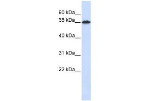 Western Blotting (WB) image for anti-Frizzled Family Receptor 4 (FZD4) (Middle Region) antibody (ABIN2776715)