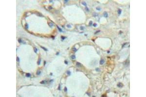 Used in DAB staining on fromalin fixed paraffin-embedded kidney tissue (Ephrin A5 抗体  (AA 21-203))