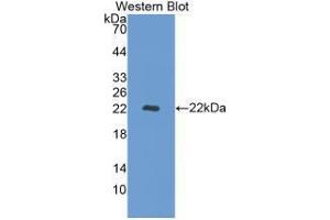 Western blot analysis of recombinant Human REV1. (REV1 抗体  (AA 301-478))