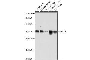 Western blot analysis of extracts of various cell lines using NPR3 Polyclonal Antibody at dilution of 1:1000. (NPR3 抗体)
