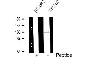 Western blot analysis of ADAM 17 expression in HT1080 whole cell lysates. (ADAM17 抗体  (C-Term))