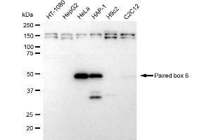 Western blotting analysis using Paired box 6 antibody (ABIN7799725). (Recombinant PAX6 抗体)