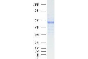 Validation with Western Blot