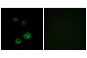 Immunofluorescence analysis of A549 cells, using NPY2R antibody. (NPY2R 抗体  (N-Term))