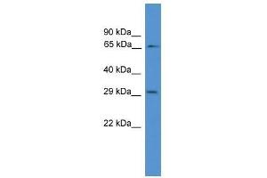 Western Blot showing GK2 antibody used at a concentration of 1-2 ug/ml to detect its target protein. (GK2 抗体  (N-Term))