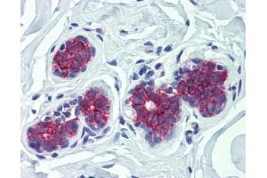 G6PC antibody was used for immunohistochemistry at a concentration of 4-8 ug/ml. (G6PC 抗体  (N-Term))