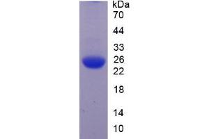 SDS-PAGE of Protein Standard from the Kit  (Highly purified E. (JAG1 ELISA 试剂盒)