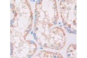 Used in DAB staining on fromalin fixed paraffin- embedded Kidney tissue (HSD17B12 抗体  (AA 1-312))
