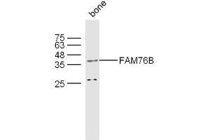 Mouse bone lysates probed with FAM76B Polyclonal Antibody, unconjugated  at 1:300 overnight at 4°C followed by a conjugated secondary antibody at 1:10000 for 60 minutes at 37°C. (FAM76B 抗体)