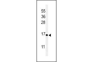 Western blot analysis of RPS25 Antibody (N-term) (ABIN653668 and ABIN2843001) in Jurkat cell line lysates (35 μg/lane). (RPS25 抗体  (N-Term))