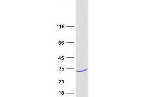Western Blotting (WB) image for Nicotinamide Riboside Kinase 1 (NMRK1) (Transcript Variant 1) protein (Myc-DYKDDDDK Tag) (ABIN2727636)