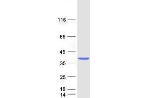 Western Blotting (WB) image for Ets Variant 7 (ETV7) protein (Myc-DYKDDDDK Tag) (ABIN2720589)