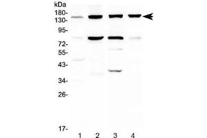 Western blot testing of 1) human HeLa, 2) human HepG2, 3) rat liver and 4) mouse liver lysate with ITGA5 antibody at 0. (ITGA5 抗体)