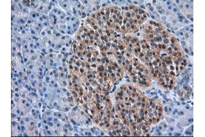 Immunohistochemical staining of paraffin-embedded Human liver tissue using anti-ACAT2 mouse monoclonal antibody. (ACAT2 抗体)
