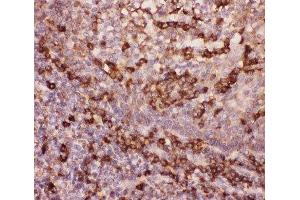 IHC-P: MAC-1 antibody testing of human tonsil tissue (Integrin beta 2 抗体  (AA 17-382))