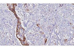 Immunohistochemistry (IHC) image for anti-ATPase, H+ Transporting, Lysosomal Accessory Protein 2 (ATP6AP2) (Internal Region) antibody (ABIN6257458)