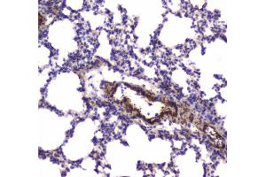 Immunohistochemistry (IHC) image for anti-Myosin Light Chain Kinase (MYLK) (AA 1441-1709) antibody (ABIN5693029)