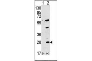 Western blot analysis of GREM1 (arrow) using Gremlin-1 / GREM1 Antibody (C-term) Cat. (GREM1 抗体  (C-Term))