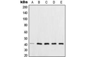 Western blot analysis of XPA expression in HCT116 (A), HeLa (B), HepG2 (C), MCF7 (D), NIH3T3 (E) whole cell lysates. (XPA 抗体  (C-Term))