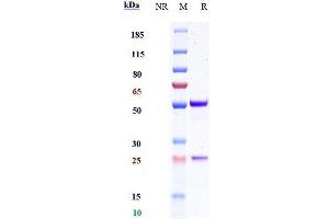 Anti-GPC2 / Glypican 2 Reference Antibody (Nih Patent Anti-Glypican-2) on SDS-PAGE under reducing (R) condition.