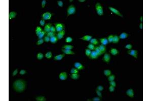 Immunofluorescence staining of PC-3 cells with ABIN7143534 at 1:266, counter-stained with DAPI. (SLC25A4 抗体  (AA 40-74))