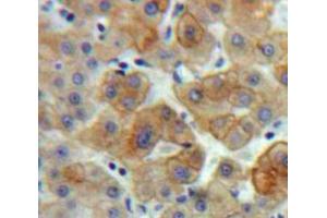 Used in DAB staining on fromalin fixed paraffin-embedded Liver tissue (BCL3 抗体  (AA 82-341))