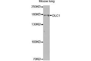 Western Blotting (WB) image for anti-Deleted in Liver Cancer 1 (DLC1) antibody (ABIN1872283) (DLC1 抗体)