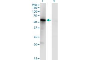 Western Blot analysis of MKNK1 expression in transfected 293T cell line by MKNK1 monoclonal antibody (M05), clone 5E2. (MKNK1 抗体  (AA 1-465))