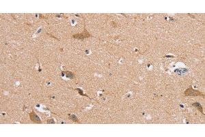 Immunohistochemistry of paraffin-embedded Human brain using MSMB Polyclonal Antibody at dilution of 1:30 (MSMB 抗体)