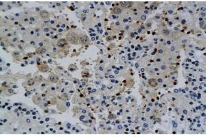 Immunohistochemistry (IHC) image for anti-Interferon gamma (IFNG) (AA 81-166) antibody (ABIN669141) (Interferon gamma 抗体  (AA 81-166))