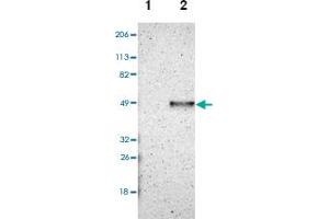 Western blot analysis of Lane 1: Human cell line RT-4, Lane 2: Human cell line U-251MG sp with CADM3 polyclonal antibody . (CADM3 抗体)