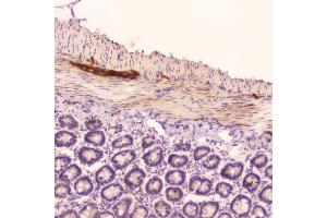 IHC analysis of ANP using anti-ANP antibody (ABIN5693163). (NPPA 抗体  (AA 25-122))