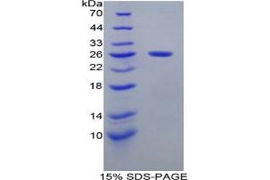 SDS-PAGE analysis of Mouse Smad1 Protein. (SMAD1 蛋白)