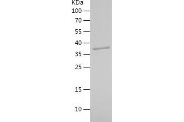 GRP94 Protein (AA 282-409) (His-IF2DI Tag)