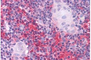 Human Thymus: Formalin-Fixed, Paraffin-Embedded (FFPE) (SOX2 抗体  (N-Term))