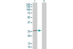 Western Blot analysis of SOD2 expression in transfected 293T cell line by SOD2 MaxPab polyclonal antibody. (SOD2 抗体  (AA 1-222))
