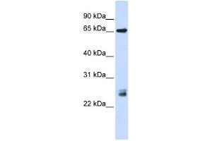 WB Suggested Anti-TRIM8 Antibody Titration:  0. (TRIM8 抗体  (N-Term))