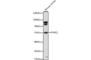 Western blot analysis of extracts of mouse kidney, using PHKG1 antibody (ABIN7269368) at 1:1000 dilution. (PHKG1 抗体  (AA 245-350))