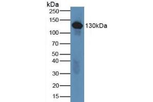 Detection of C6 in Human Serum using Polyclonal Antibody to Complement Component 6 (C6) (C6 抗体  (AA 682-934))