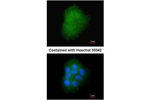 ICC/IF Image Immunofluorescence analysis of paraformaldehyde-fixed A431, using Transmembrane protein 147, antibody at 1:200 dilution. (TMEM147 抗体)