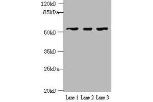 Western blot All lanes: IFIT5 antibody at 2 μg/mL Lane 1: A375 whole cell lysate Lane 2: Jurkat whole cell lysate Lane 3: HepG2 whole cell lysate Secondary Goat polyclonal to rabbit IgG at 1/10000 dilution Predicted band size: 56, 51 kDa Observed band size: 56 kDa (IFIT5 抗体  (AA 107-320))