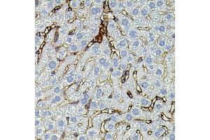 Immunohistochemistry of paraffin-embedded mouse liver using MMP9 antibody (ABIN4904401) at dilution of 1:100 (40x lens). (MMP 9 抗体)