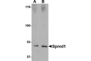 Western Blotting (WB) image for anti-Sprouty-Related, EVH1 Domain Containing 1 (SPRED1) (Middle Region 2) antibody (ABIN1031204) (SPRED1 抗体  (Middle Region 2))