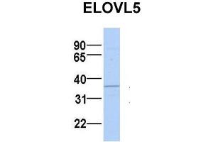 Host:  Rabbit  Target Name:  ELOVL5  Sample Type:  MCF7  Antibody Dilution:  1. (ELOVL5 抗体  (N-Term))