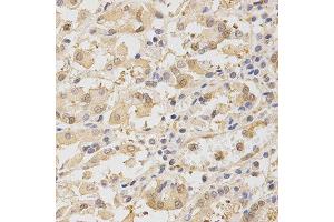 Immunohistochemistry of paraffin-embedded human stomach using TOLLIP antibody at dilution of 1:200 (x400 lens) (TOLLIP 抗体  (AA 1-274))
