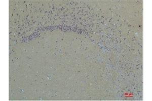 Immunohistochemistry (IHC) analysis of paraffin-embedded Rat Brain Tissue using Glutamate Receptor 1 Rabbit Polyclonal Antibody diluted at 1:200. (Glutamate Receptor 1 抗体)